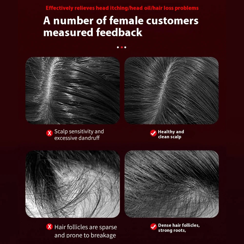 LUAFO™ LauraStim™ LED Hair Brush